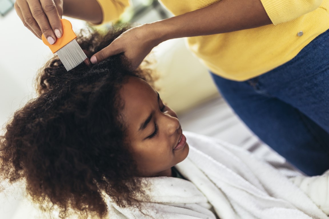 How to treat nits Prevent head lice in children at nursery school